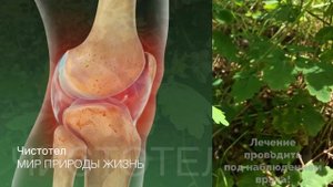 Чистотел- лекарство от ста болезней. Бородавник, желтушник, золотая трава в народной медицине