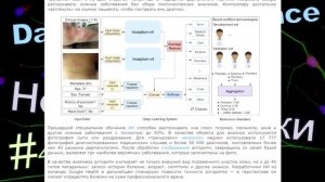 [Дайджест]#4 Новости науки /Умные протезы и диагноз по фото!