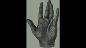 SCP-610 _ _Ненавидящая Плоть.