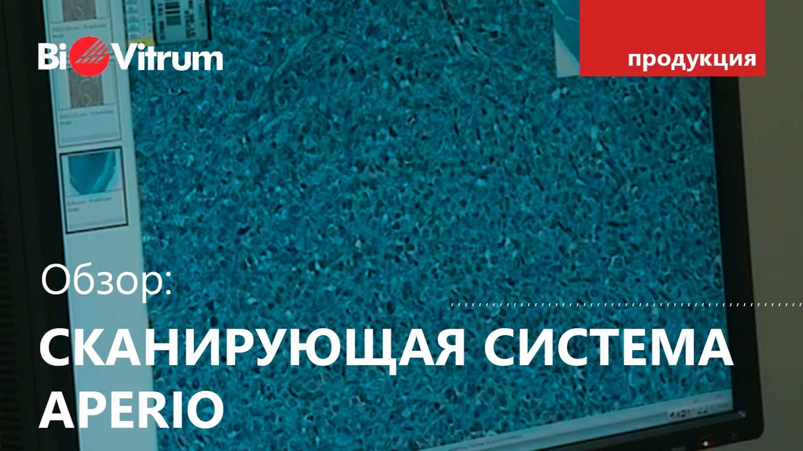 ПАО ФНКЦ: телемедицина Aperio (Аперио)