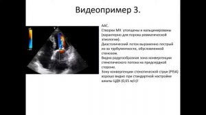 ОСНОВЫ ЭХОКАРДИОГРАФИИ  Митральная недостаточность