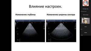 Рогатова А.Н. "Ультразвуковые исследования в медицине. Вводная лекция" (15.09.2023)