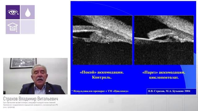 Анатомия и физиология аккомодации