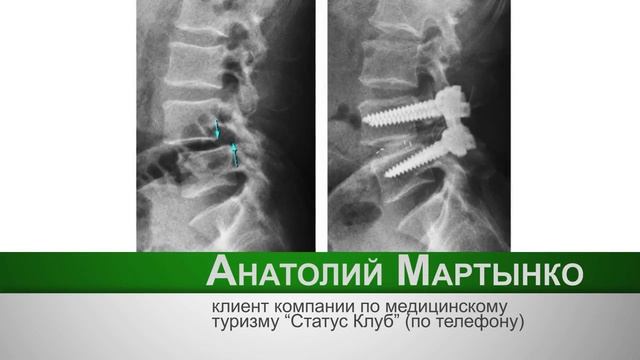 Статус Клуб 3 Ортопедия смотреть онлайн
