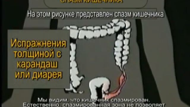 Причины многих заболеваний начинаются в грязном кишечнике. смотреть онлайн