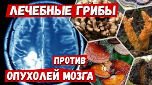 ЛЕЧЕБНЫЕ ГРИБЫ против опухолей мозга. Глиобластома. Астроцитома. Каков эффект?