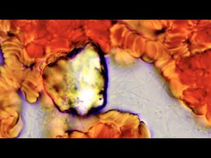 Это спасает алкоголиков от гибели / смотрю кровь алкоголика со стажем