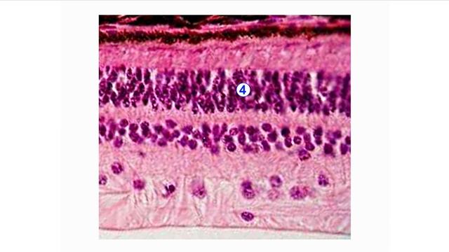 Задняя стенка глаза гематоксилин эозин