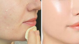 Отбеливающая маска для лица своими руками. Чистая кожа в домашних условиях, рецепт