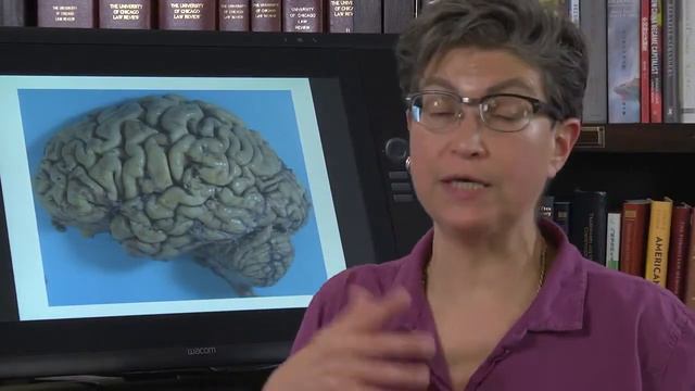 Синдромы инсульта от проф. Пегги Мейсон университет Чикаго с русской озвучкой