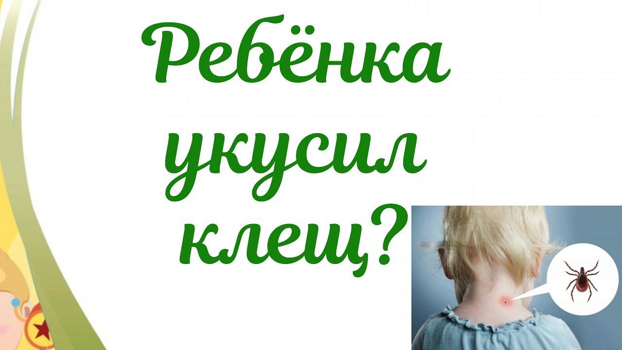 РЕБЕНКА УКУСИЛ КЛЕЩ! Алгоритм действий при укусе клеща. смотреть онлайн