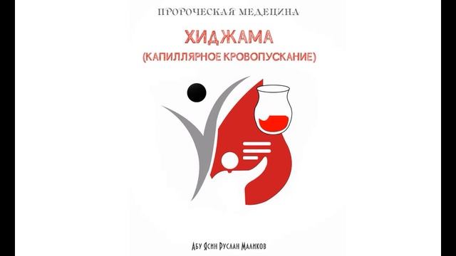 29) Хиджама - капиллярное кровопускание