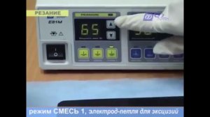 Удаление папиллом и родинок на аппарате «Фотек»