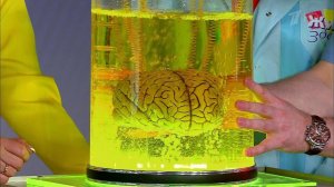 Сотрясение мозга у детей и взрослых. Жить здорово! Фрагмент выпуска от 07.06.2016