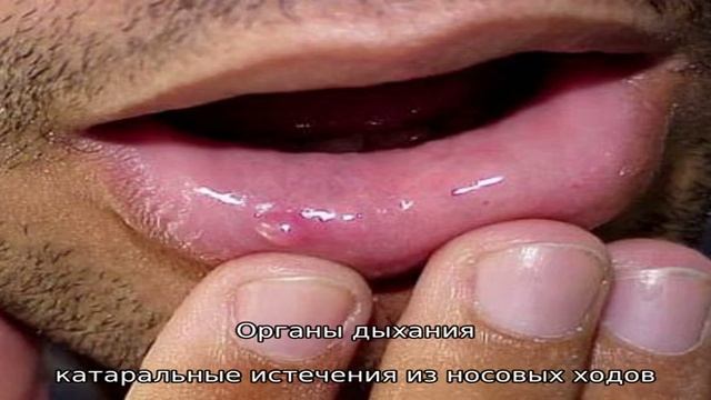 Способы диагностики чумы коров и меры устранения болезни смотреть онлайн