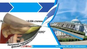 Уникальные противоожоговые и ранозаживляющие повязки и гидрогель АППОЛО