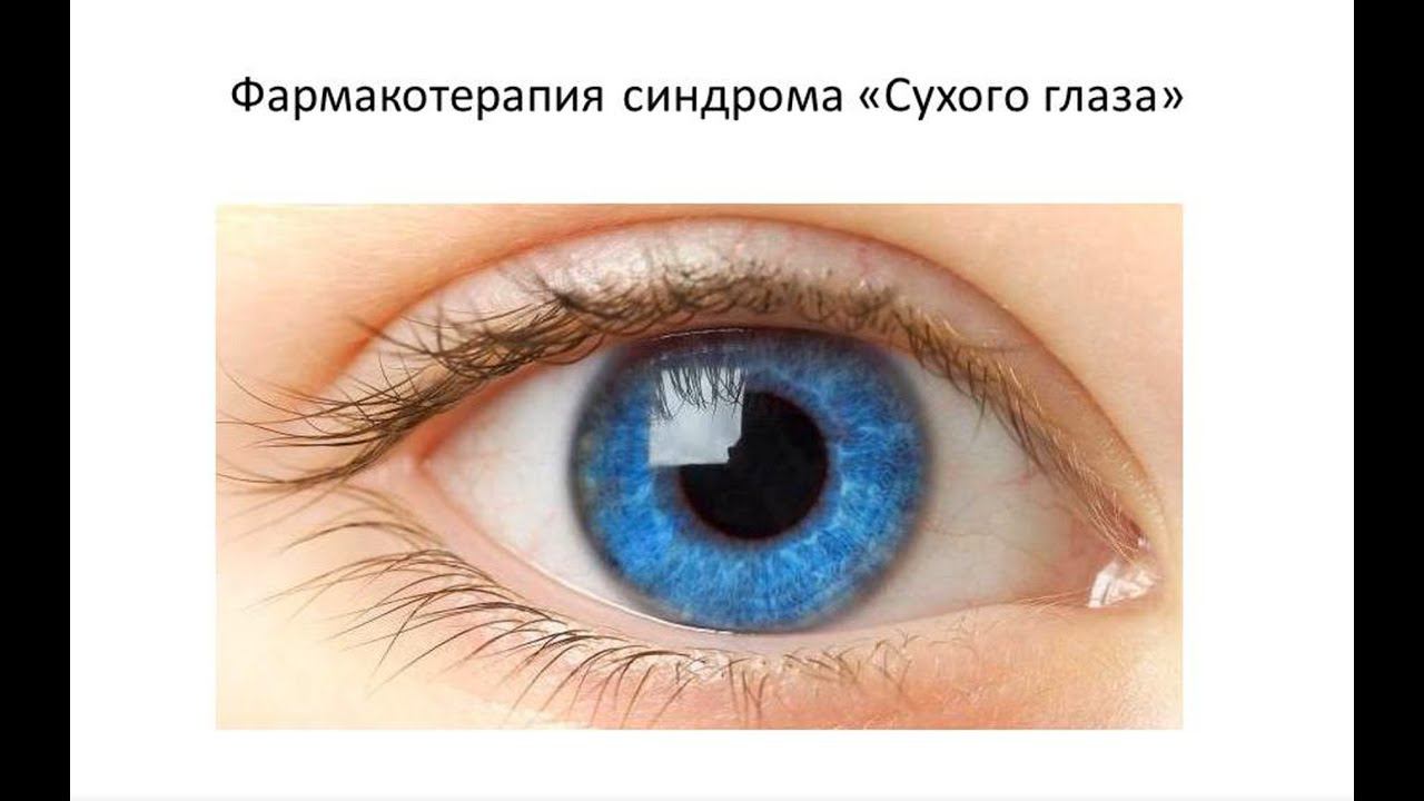 Синдром сухого глаза смотреть онлайн
