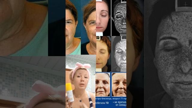 Остановить фотостарение возможно смотреть онлайн