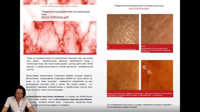 «Соединительнотканная стимуляция mmas® c аппаратом icoone laser в санаторно – курортной практике» смотреть онлайн