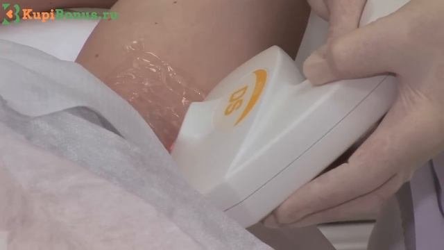 Избавление от  волос : элос-эпиляция подмышек
