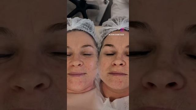 #здоровье #красота #уходзакожей #косметолог #уходзалицом #крем #красотаиздоровье #косметика #кожа смотреть онлайн