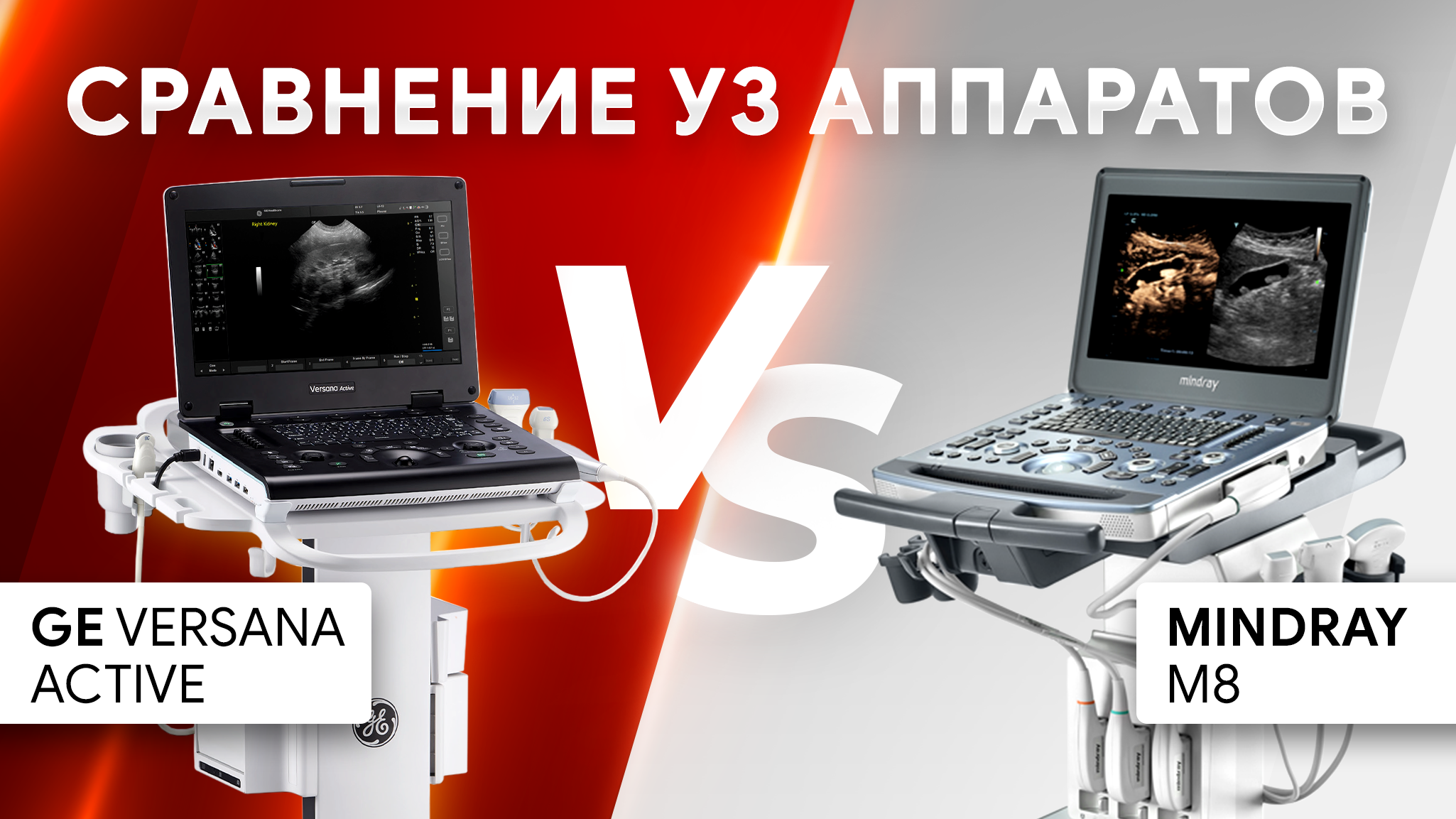 Mindray M8 или GE Versana Active? Сравнение УЗИ аппаратов