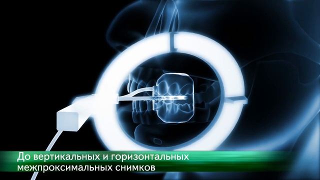 Визиограф