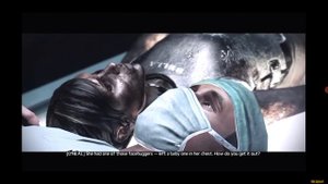 Можно ли вообще извлечь грудолома ?