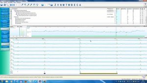 KTResult3 - выделение пауз по длительности