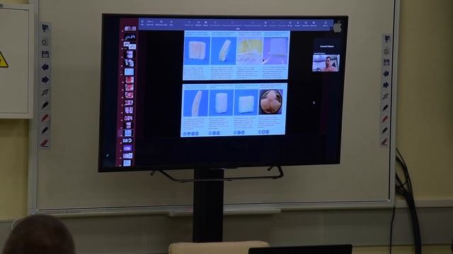 Панцулая В.Г. Использование 3Д-индивидуальных костных блоков для реабилитации зубо-челюстной систем смотреть онлайн