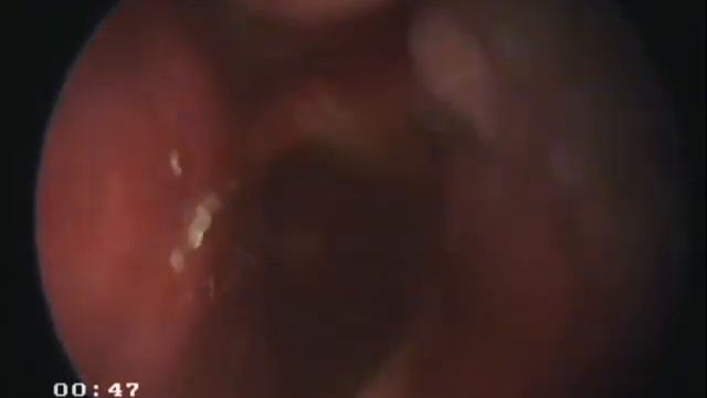 Аспергилез у овчарки смотреть онлайн