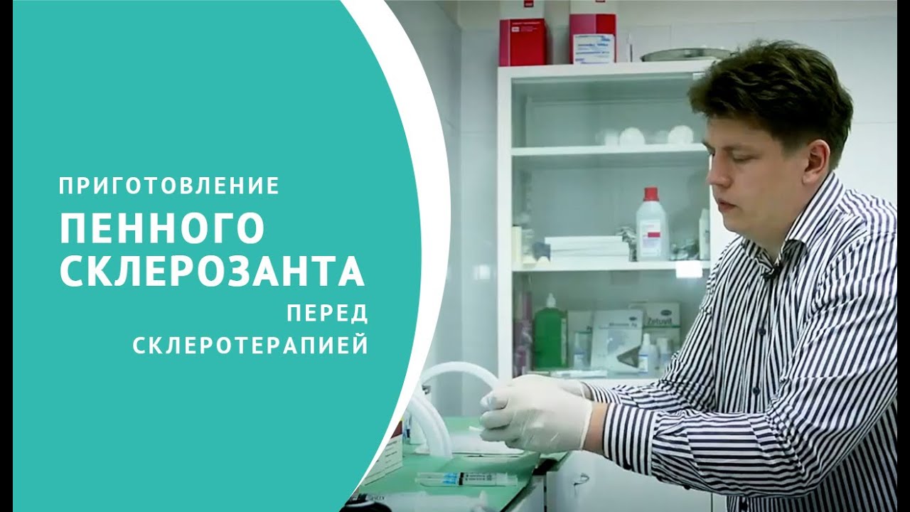 Приготовление пены для склеротерапии вен