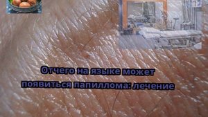 Отчего на языке может появиться папиллома: лечение