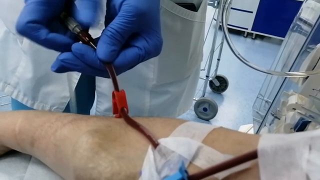 Гемодиализ. Подключение от первого лица. Иду на гемодиализ. Гемодиализ как есть. Гемодиализ Рязань.