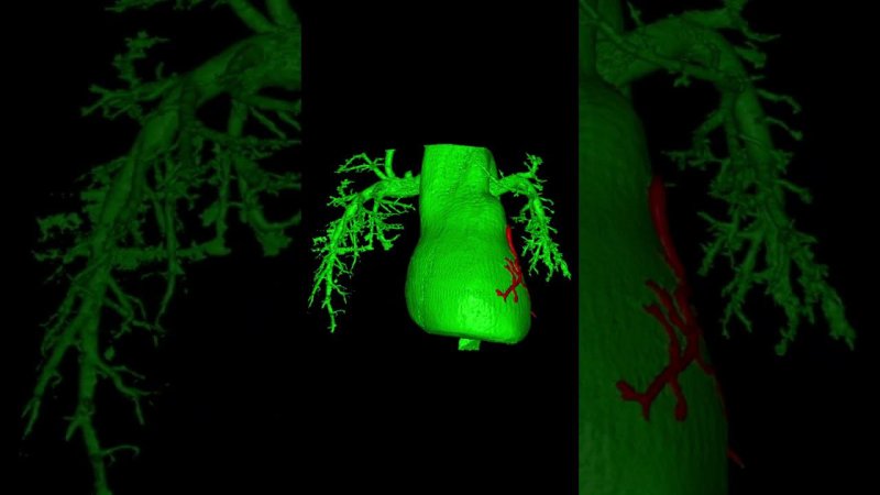 Visualization of Heart CT Phantom