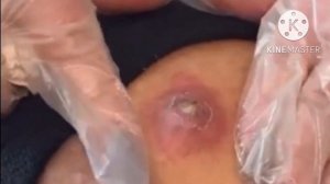 СРОЧНО!!! ОГРОМНЫЙ ПРЫЩ!!!!