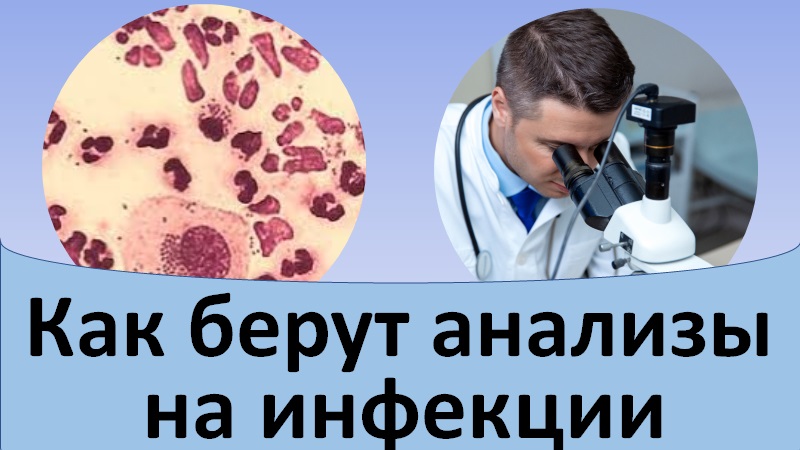 Как берут анализы на половые инфекции.