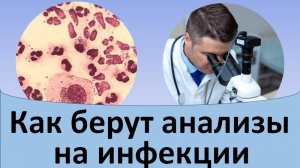 Как берут анализы на половые инфекции.