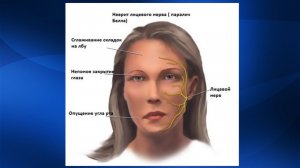 2.31. Массаж при невропатиях и невралгииях нервов лица и головы | Медицинский массаж. Цикл 2