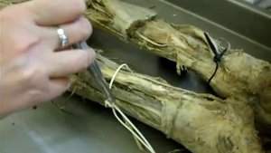 Анатомия (крестцовое сплетение) plexus sacralis