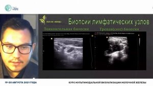 УЗИ лимфатических узлов в онкологии