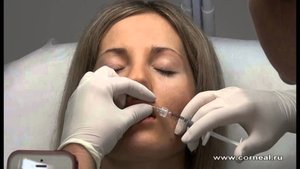 Колим губы Принцесс Filler