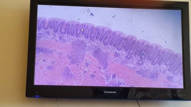 Гистология Срез языка смотреть онлайн