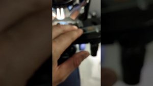 ЧЕРВИ В ГЛАЗУ. СОПЛИ, НОГТИ, СЛЮНИ ПОД МИКРОСКОПОМ