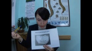 Остеохондроз позвоночника : стадии и его признаки