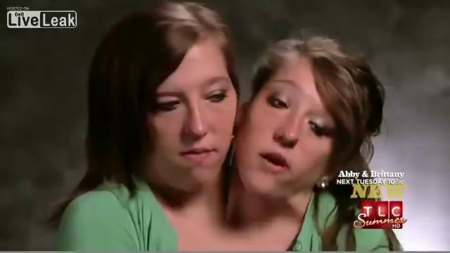 Две девочки с Oдним телом! Невероятно! смотреть онлайн