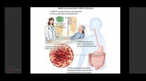 Botulinum and miscellaneous anaerobes / Clostridium / MICROBIOLOGY