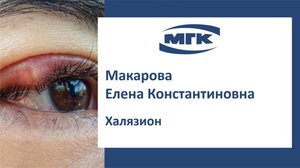 Макарова Елена Константиновна: халязион