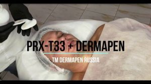 Протокол процедуры PRX-T33 и Дермапен DRA6 Premium. Правильное исполнение.