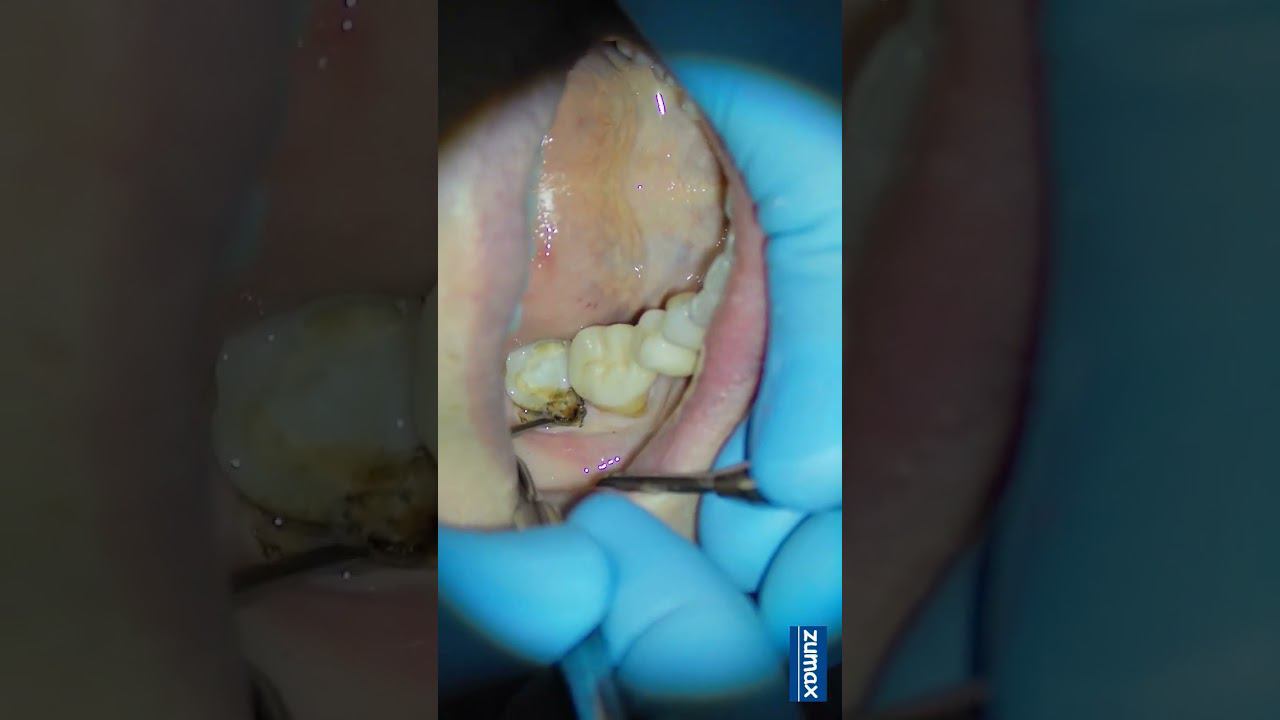 стоматологическая некрофилия #zumax смотреть онлайн